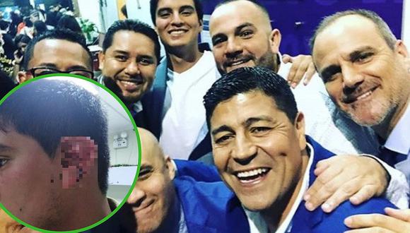 Extranjero Golpea Brutalmente A Conocido Periodista De Latina Fotos Y V Deo Ojo Show Ojo