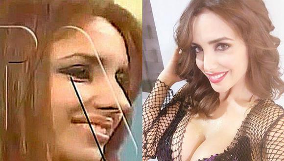 ¿Qué te pasó Rosángela Espinoza? Mira el antes y después de la modelo [FOTOS]