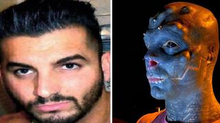 Hombre se somete a delicada operación para cumplir su sueño: tener apariencia de alienígena | FOTOS Y VIDEOS