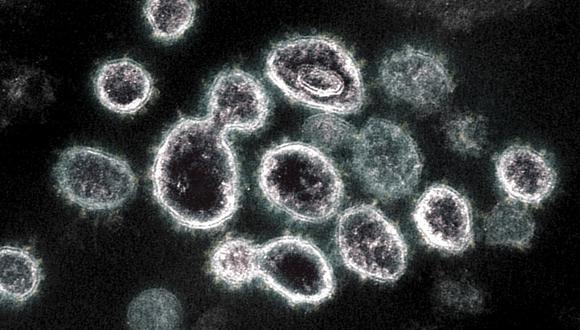 La OMS reconoce que algunas de las nuevas mutaciones de la variante omicrón parecen sugerir una aún mayor capacidad de transmisión que cepas anteriores. (Foto: National Institute of Allergy and Infectious Diseases / AFP)