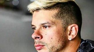 ¡Totalmente rapado! Mario Hart cambia de look y da que hablar 