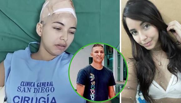 Mujer pierde cuero cabelludo tras negarse a tener intimitad con su ex pareja (FOTOS y VÍDEO)