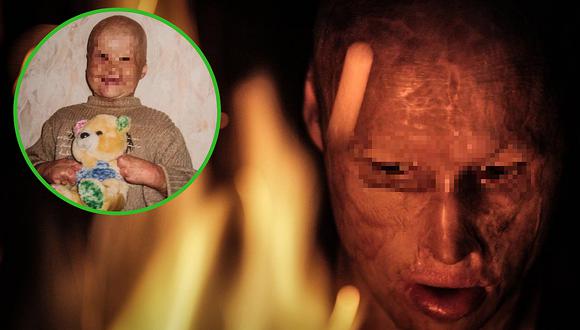 Loysha, el niño que salvó de morir quemado al ser lanzado a un horno por su propio padre