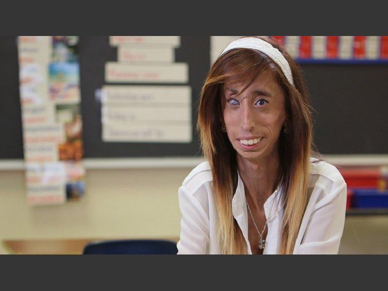 La historia de Lizzie: ¡Fue llamada 'la mujer más fea del mundo' y hoy lucha contra el bullying!