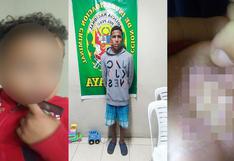 Arequipa: Venezolano quema manos a su hijo de un año tras discutir con su pareja