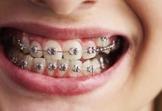 Brackets: ¿Cuáles son las consecuencias de una mala higiene durante una ortodoncia?