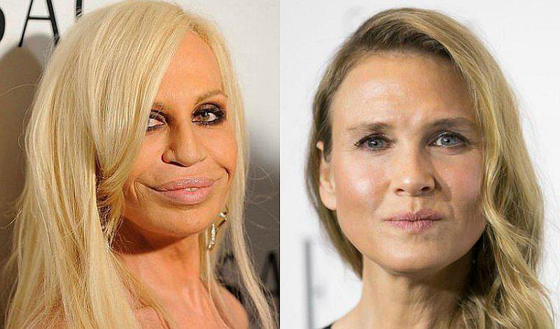 5 famosas que perjudicaron sus rostros por las cirugías  