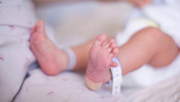 Bebé con 24 dedos nace en Chimbote