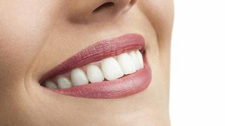 7 efectos del estrés en la salud bucal