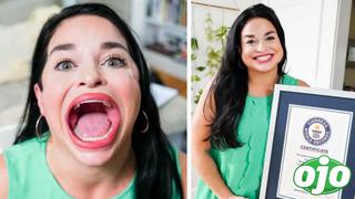 Conoce a Samantha, la mujer con la boca más grande del  mundo | FOTOS