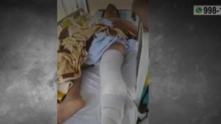 Joven fue atropellado por auto que se dio a la fuga y queda con las piernas fracturadas: “Dejó a mi hijo como cualquier cosa”