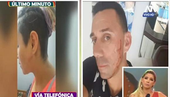 ​Miguel Rebosio: expareja lo acusa de agresión y de haber hecho lo peor (VIDEO)