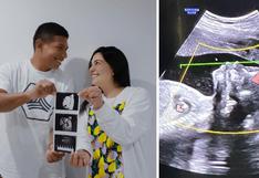 Ana Siucho confirma que su bebé será mujer y revela el nombre | FOTO 