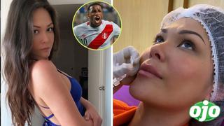 Giulliana Barrios se hizo este ‘retoquito’ en el rostro tras ampay con Jefferson Farfán | FOTO 