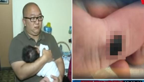 Papito denuncia que quemaron pie de su bebé recién nacido en conocida clínica (VIDEO)