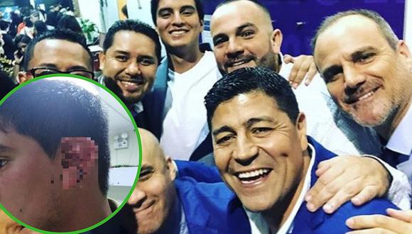 Extranjero golpea brutalmente a conocido periodista de Latina (FOTOS y VÍDEO)