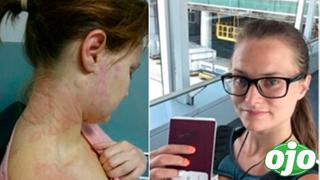 Mujer se vuelva alérgica al trabajo y se cura viajando por el mundo