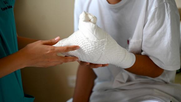 Los médicos lograron rescatar los otros dedos y aplicar una matriz acelular para facilitar la recuperación y la funcionalidad de la mano dañada.