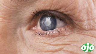 ¿Cómo debe cuidarse un paciente con glaucoma en tiempos de pandemia?