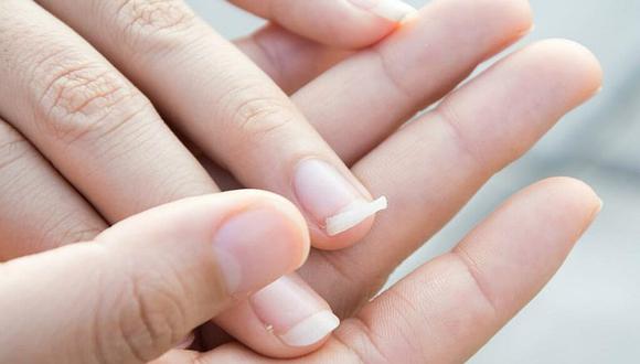 Recomendaciones que debes tomar en cuenta para tener las uñas sanas