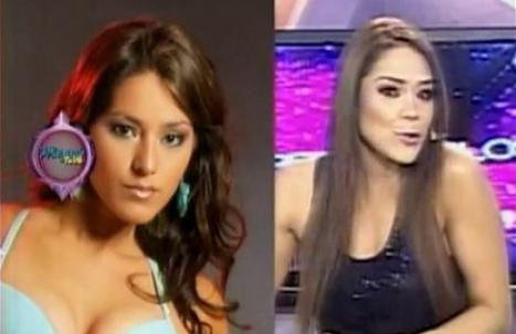 Nueva foto del antes de Karen Schwarz