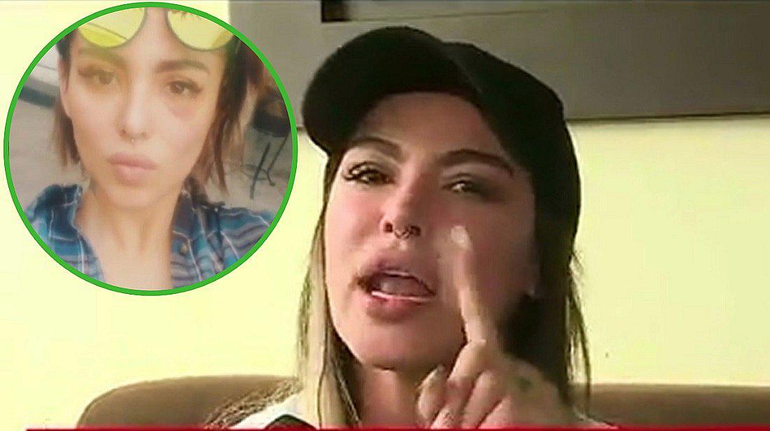 Angie Jibaja aparece con el ojo morado pero ‘jura’ que nadie le pegó (VIDEO)
