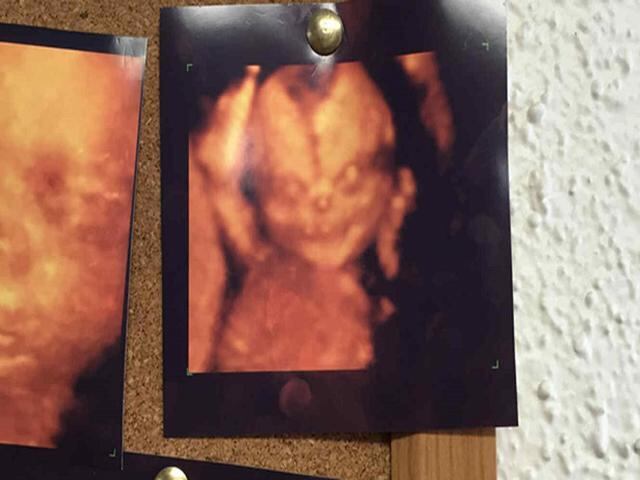 ​Reddit: Hombre se entera por ultrasonido que será padre de un "demonio" [FOTO]