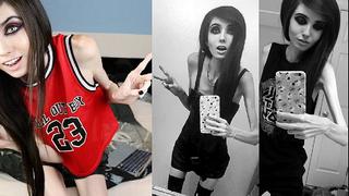 YouTube: Piden que cierre canal de joven de 27 kilos por inducir a la anorexia