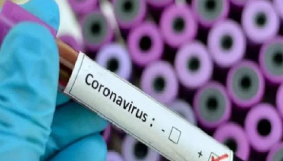Las pruebas para detectar el coronavirus ahora se realizan en el Laboratorio de Referencia Regional de Arequipa.