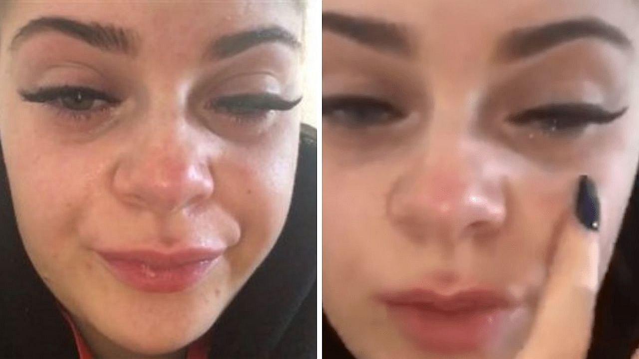 Joven queda con ceguera temporal luego que le colocaran pestañas postizas