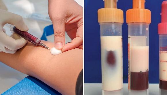 Doctores extraen sangre a paciente y se sorprender al ver que es blanca como la leche