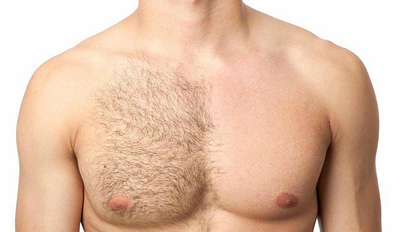 Conoce el método de depilación para hombres que no duele