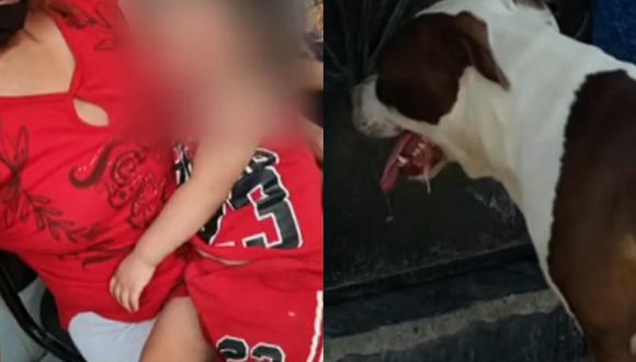 Pitbull agravia y desfigura a niña de dos años en la puerta de su casa. Foto: TV Perú Noticias
