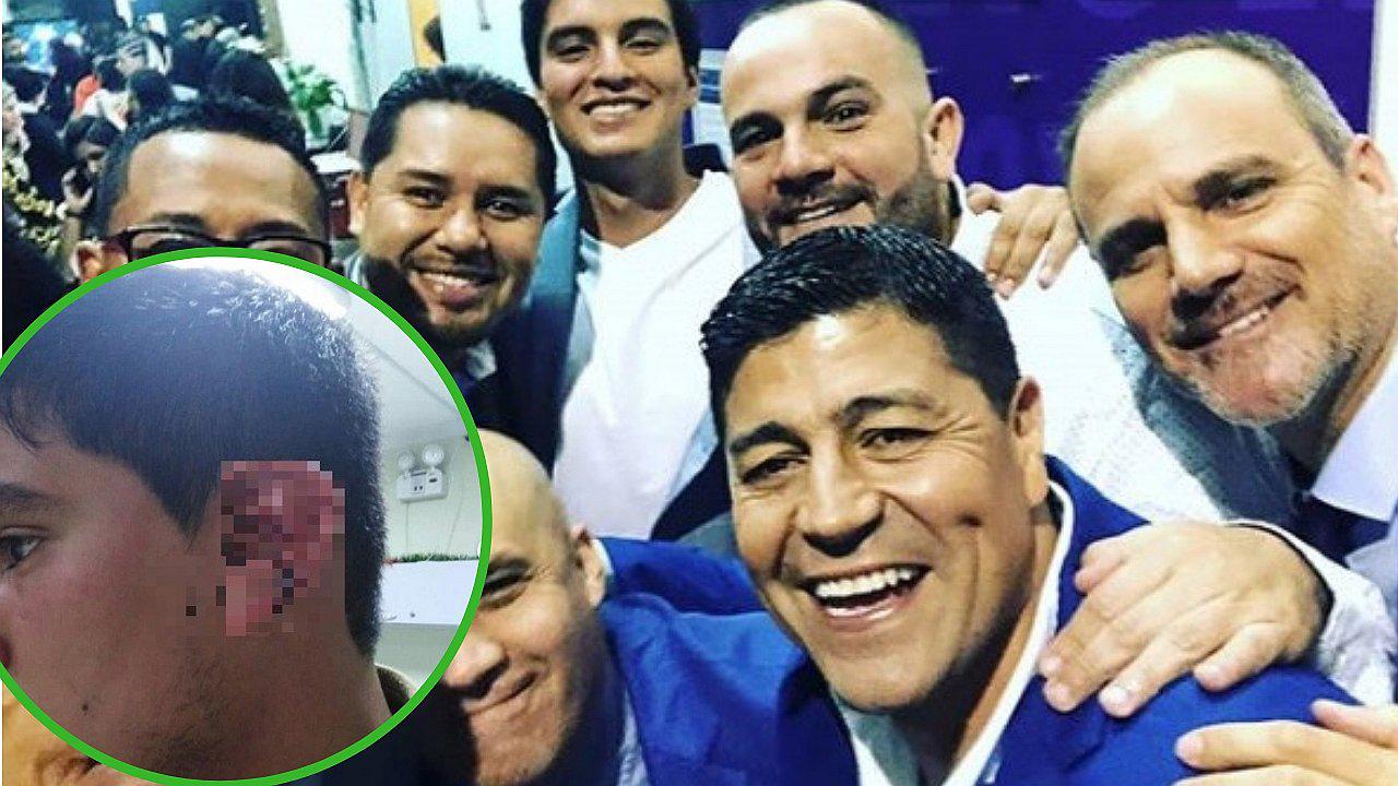 Extranjero golpea brutalmente a conocido periodista de Latina (FOTOS y VÍDEO)