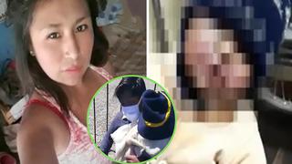 Madre le quema el rostro a su bebé con ácido en Puno | VIDEO