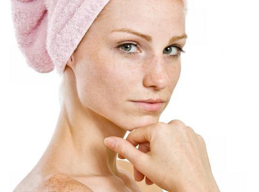 Tips para eliminar las pecas del rostro de forma natural