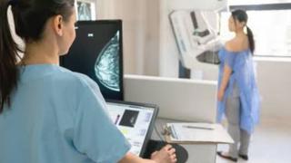 Todo lo que debes saber sobre la mamografía para detectar el cáncer de mama a tiempo