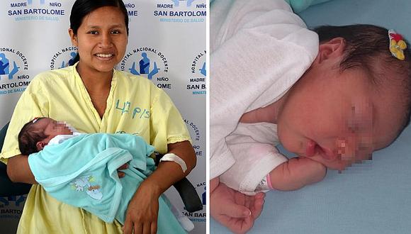 Nace primera niña en el “Día internacional de la Mujer” en el Hospital “San Bartolomé”