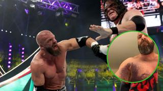 Triple H se someterá a cirugía tras ganarle a Undertaker y Kane en reciente evento de la WWE (FOTO)