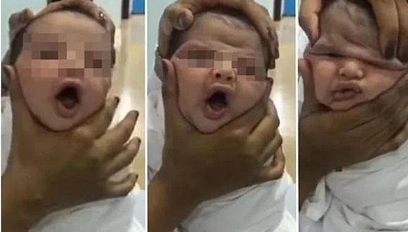 Enfermeras se graban manipulando la carita de un bebito y causa indignación en redes 