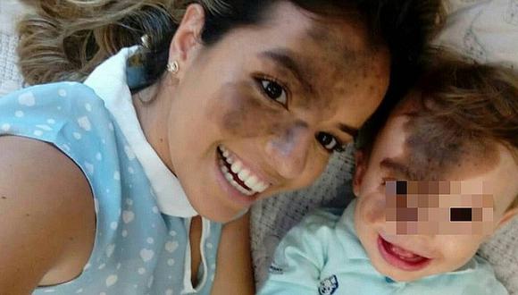 Mamita conmueve al pintarse en la cara una mancha similar a la de su bebé 