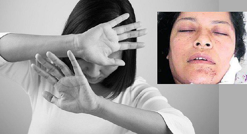 San Juan de Miraflores: mujer es acuchillada porque debía 300 soles de renta