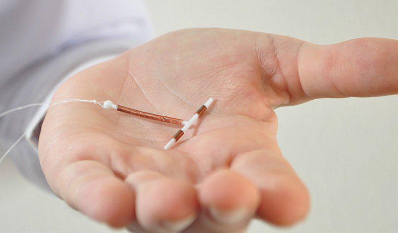 Planificación familiar: Ventajas y desventajas de usar la "T de cobre" 