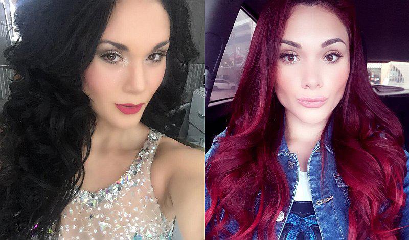 Génesis Tapia se realiza técnica de tensado facial para evitar la flacidez