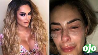 Ninel Conde: salen a la luz fotos de la actriz con el rostro desfigurado tras denuncia de agresión