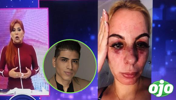 Dalia Durán termina con el rostro desfigurado tras presunta agresión de John Kelvin | VIDEO