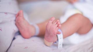 Bebé con 24 dedos nace en Chimbote