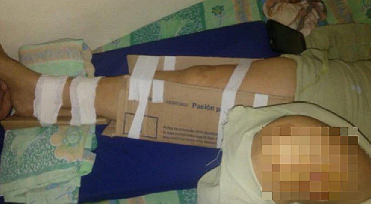 Hospital se queda sin presupuesto y enyesa a su paciente con cartón 