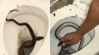 Serpiente muerde miembro viril de joven cuando estaba sentando en inodoro | FOTOS