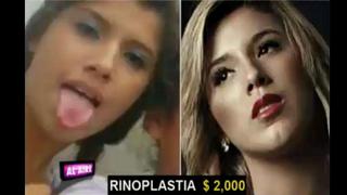 ​Yahaira Plasencia: ¿Cuántos miles de dólares gastó en cirugías? [VIDEO]